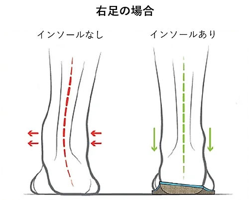 インソール.jpg